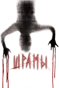 <h1>Шрамы 3D</h1>